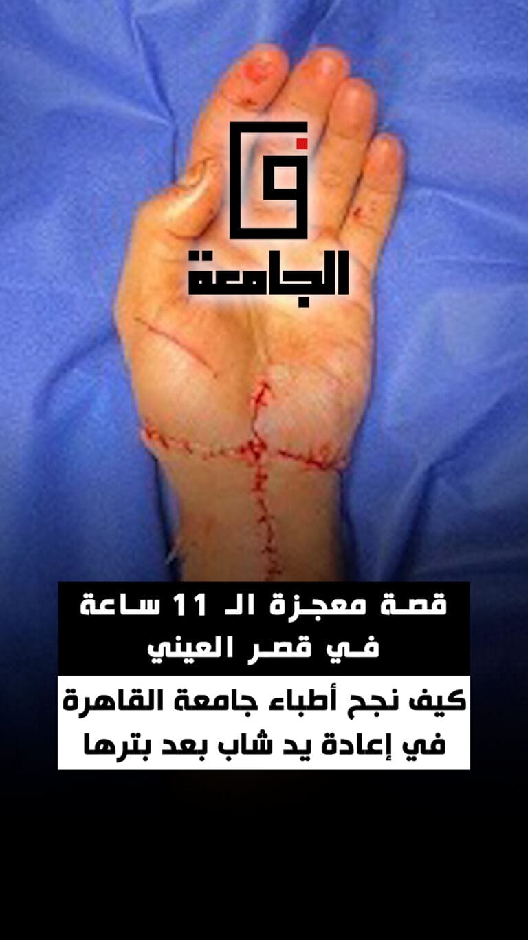 القصة الكاملة لمعجزة أطباء قصر العيني في إعادة يد شاب بعد بترها في مشاجرة (فيديوجراف) 10 Cover 4 عبد الغفار القصة الكاملة لمعجزة أطباء قصر العيني في إعادة يد شاب بعد بترها في مشاجرة (فيديوجراف) موقع في الجامعة