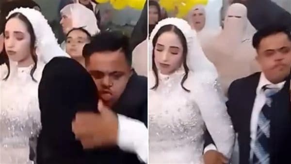 بعد واقعة عريس متلازمة داون.. أستاذ طب نفسي يوضح الحالات التي يمنع فيها الزواج 2 552 العقد بعد واقعة عريس متلازمة داون.. أستاذ طب نفسي يوضح الحالات التي يمنع فيها الزواج موقع في الجامعة