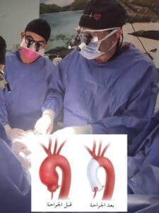 جامعة قناة السويس تنجح في إجراء واحدة من أعقد جراحات القلب والصدر عالميًا 2 IMG 20250801 WA0029 جامعة قناة السويس جامعة قناة السويس تنجح في إجراء واحدة من أعقد جراحات القلب والصدر عالميًا موقع في الجامعة