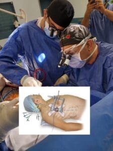 نجاح جراحة متقدمة لإصلاح الصمام الميترالي بالمنظار في مستشفيات جامعة قناة السويس 2 IMG 20250821 WA0154 قناة السويس نجاح جراحة متقدمة لإصلاح الصمام الميترالي بالمنظار في مستشفيات جامعة قناة السويس موقع في الجامعة