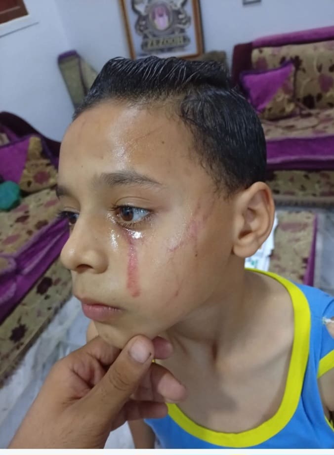استغاثة أب بعد اعتداء على نجله داخل مدرسة ببني سويف تُشعل مواقع التواصل: "ابني رجعلي مكسور من جوا"