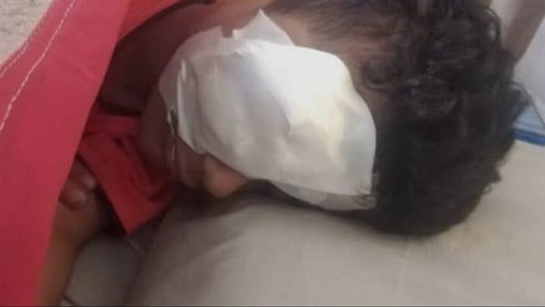 123 طالب "حدفه بحجر".. إصابة طالب بانفجار في العين داخل مدرسة بكرداسة موقع في الجامعة