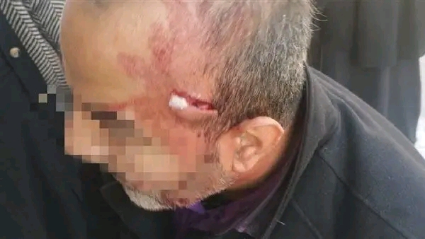 1765394116791 شخص القبض على شخص ادعى أنه والد طالبة بعد اعتدائه على معلم بمقص بالإسماعيلية موقع في الجامعة