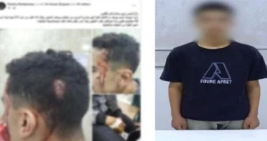 202512020532543254 اعتداء المزاح يتحول لجروح خطيرة.. تفاصيل الاعتداء على طالب بالشرقية موقع في الجامعة