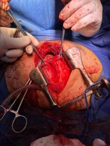 نجاح فريق طبي بسوهاج الجامعي في إنقاذ شاب من طعنة قاتلة بالقلب والرئة 3 FB IMG 1766148973702 فريق نجاح فريق طبي بسوهاج الجامعي في إنقاذ شاب من طعنة قاتلة بالقلب والرئة موقع في الجامعة