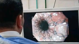جامعة المنوفية تعلن نجاح فريق طبي في التعامل مع حالات حرجة بالمريء باستخدام المناظير العلاجية 5 1767973305287 فريق جامعة المنوفية تعلن نجاح فريق طبي في التعامل مع حالات حرجة بالمريء باستخدام المناظير العلاجية موقع في الجامعة