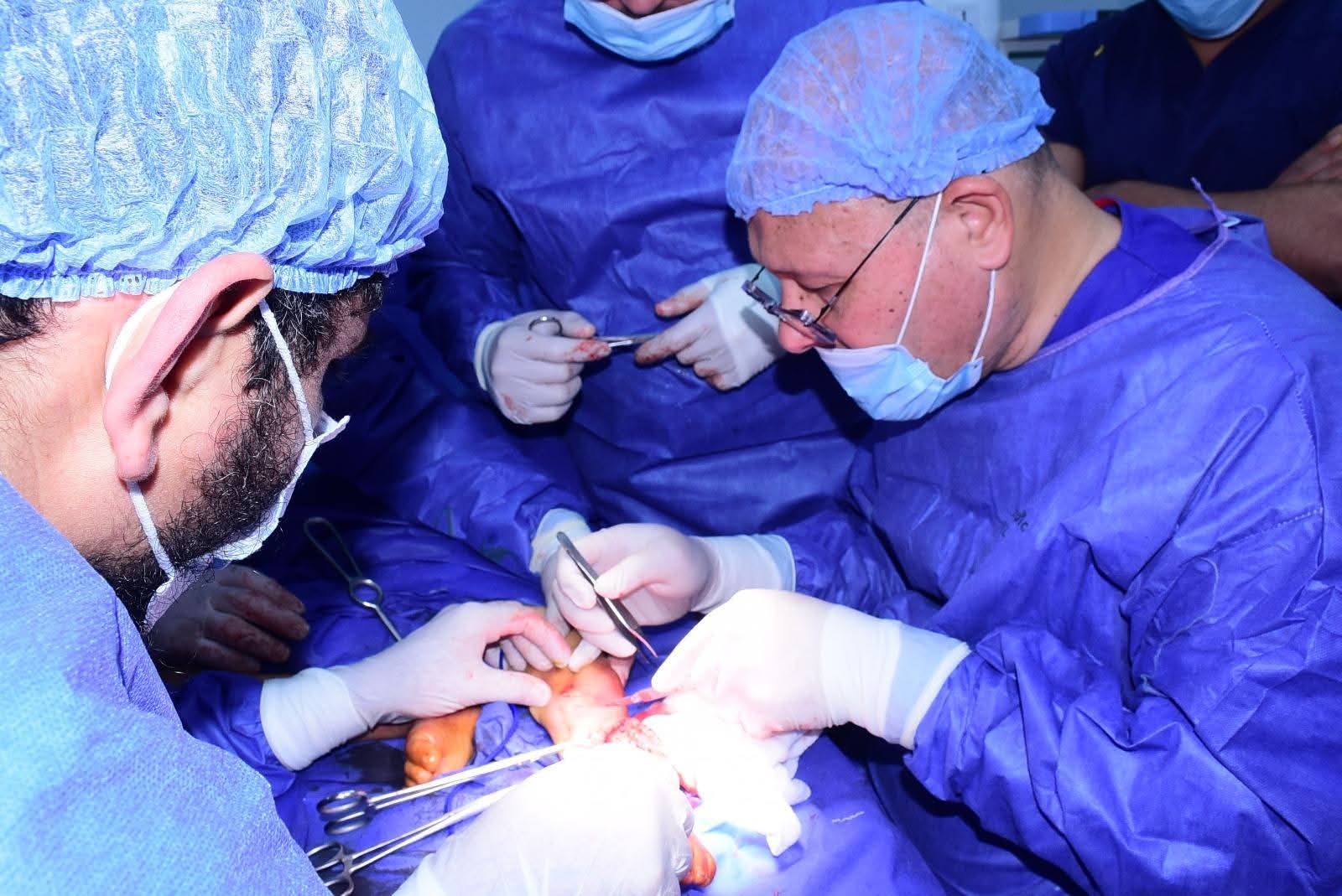 إعادة بناء عظمة القصبة لطفل 4 أعوام بمستشفى جامعة سوهاج