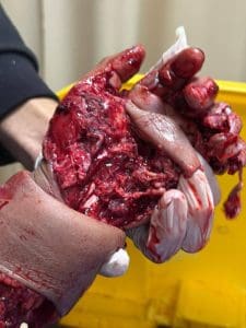 إنقاذ ذراع طفل بحادث طاحونة قمح.. فريق طبي متخصص بمستشفى الطوارئ بجامعة سوهاج يحقق معجزة طبية 3 إنقاذ ذراع طفل بحادث طاحونة قمح