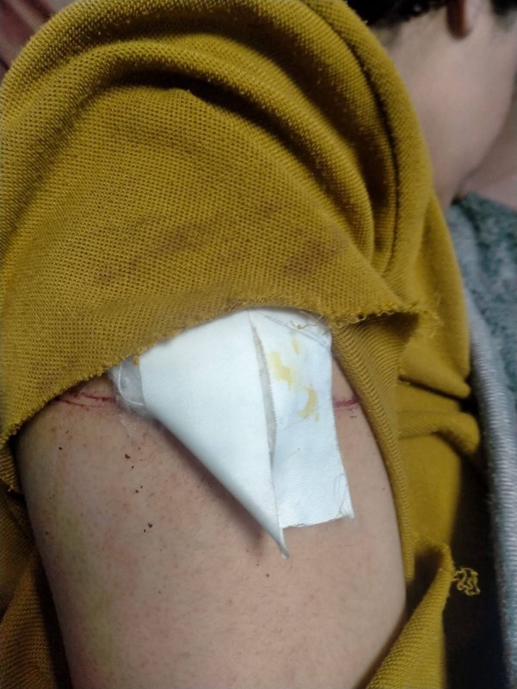 أصابوا زميلتهم بسلاح أبيض داخل مدرسة بالإسكندرية.. فصل طالبتين عام وإحالة إدارة المدرسة للتحقيق