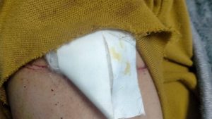 أصابوا زميلتهم بسلاح أبيض داخل مدرسة بالإسكندرية.. فصل طالبتين عام وإحالة إدارة المدرسة للتحقيق 2 أصابوا زميلتهم بسلاح أبيض داخل مدرسة بالإسكندرية.. فصل طالبتين عام وإحالة إدارة المدرسة للتحقيق