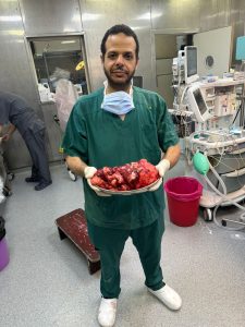 في جراحة دقيقة استمرت 5 ساعات.. فريق قصر العيني يستأصل ورمًا نادرًا يزن 9 كيلوجرامات لمريض ستيني