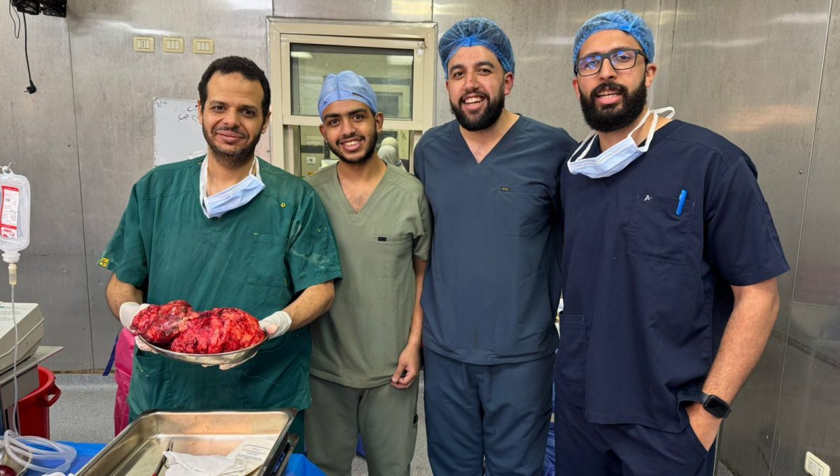 IMG 20260605 WA0051 فريق قصر العيني يستأصل ورمًا نادرًا يزن 9 كيلوجرامات في جراحة دقيقة استمرت 5 ساعات.. فريق قصر العيني يستأصل ورمًا نادرًا يزن 9 كيلوجرامات لمريض ستيني موقع في الجامعة