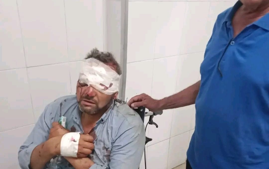 إصابة معلمين في انقلاب دراجة نارية أثناء توجههما للمراقبة 