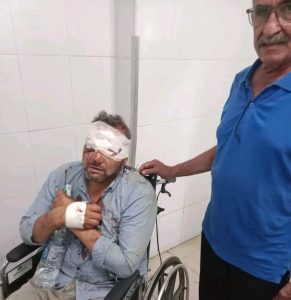 إصابة معلمين في انقلاب دراجة نارية أثناء توجههما للمراقبة بامتحانات الشهادة الإعدادية في بني سويف 2 إصابة معلمين في انقلاب دراجة نارية أثناء توجههما للمراقبة