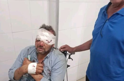 إصابة معلمين في انقلاب دراجة نارية أثناء توجههما للمراقبة 