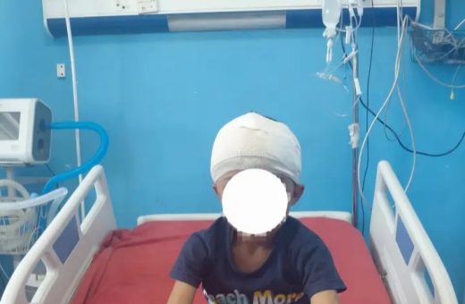 مستشفيات سوهاج الجامعية تنجح في استخراج رصاصة من مخ طفل