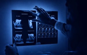 بمصروفات تصل لـ67.5 ألف جنيه وحد أدنى 77%.. تعرف على مصروفات طب أسنان الأهرام الكندية 4 مصروفات طب أسنان الأهرام الكندية