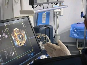 10bcdf52 1e47 4fad 9003 f52b61ef4de0 جامعة سوهاج لأول مرة بالمستشفيات الجامعية.. جامعة سوهاج تنجح في إصلاح الصمام الميترالي بالقسطرة موقع في الجامعة