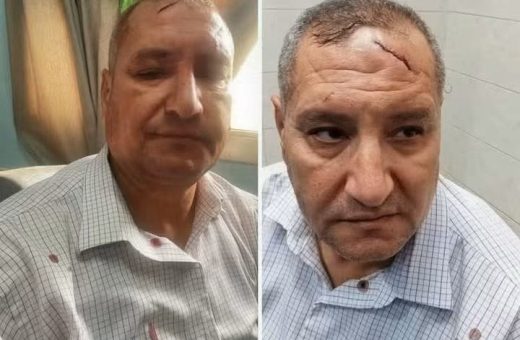 IMG 20260915 WA0150 إصابة مدير مدرسة بـ17 غرزة بعد اعتداء ولي أمر عليه إصابة مدير مدرسة بـ17 غرزة بعد اعتداء ولي أمر عليه في الدقهلية.. ونقابة المعلمين تتحرك موقع في الجامعة