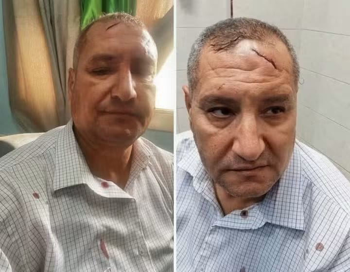IMG 20260915 WA0150 إصابة مدير مدرسة بـ17 غرزة بعد اعتداء ولي أمر عليه إصابة مدير مدرسة بـ17 غرزة بعد اعتداء ولي أمر عليه في الدقهلية.. ونقابة المعلمين تتحرك موقع في الجامعة
