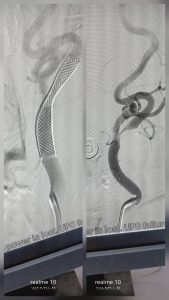 FB IMG 1793100054001 جامعة المنيا تنجح في إجراء 5 تدخلات بالقسطرة جامعة المنيا تنجح في إجراء 5 تدخلات بالقسطرة المخية خلال يوم واحد موقع في الجامعة