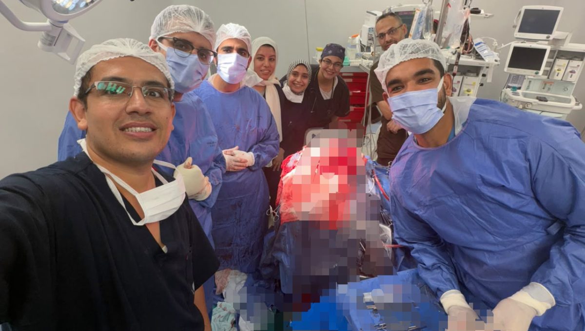 أطباء قصر العيني ينجحون في استخراج مسمار من جمجمة مريض 