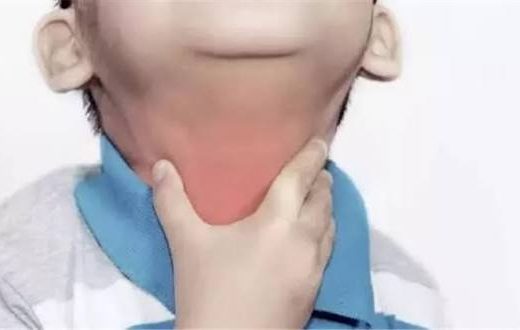 أعراض الخناق الحنجري عند الأطفال وطرق الوقاية