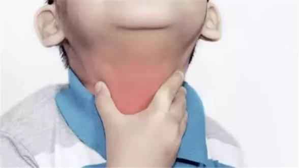 أعراض الخناق الحنجري عند الأطفال وطرق الوقاية